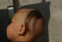 断髪式を受ける前（3歳未満）の子どもの頭部。